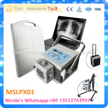 MSLPX01-i Vollständige digitale Mini-portable Röntgengerät / Röntgengerät CE CE